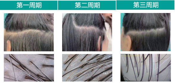 三周期