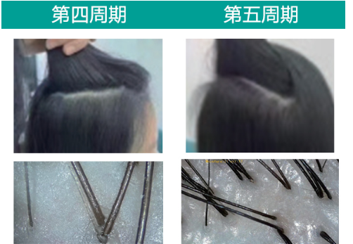 两周期